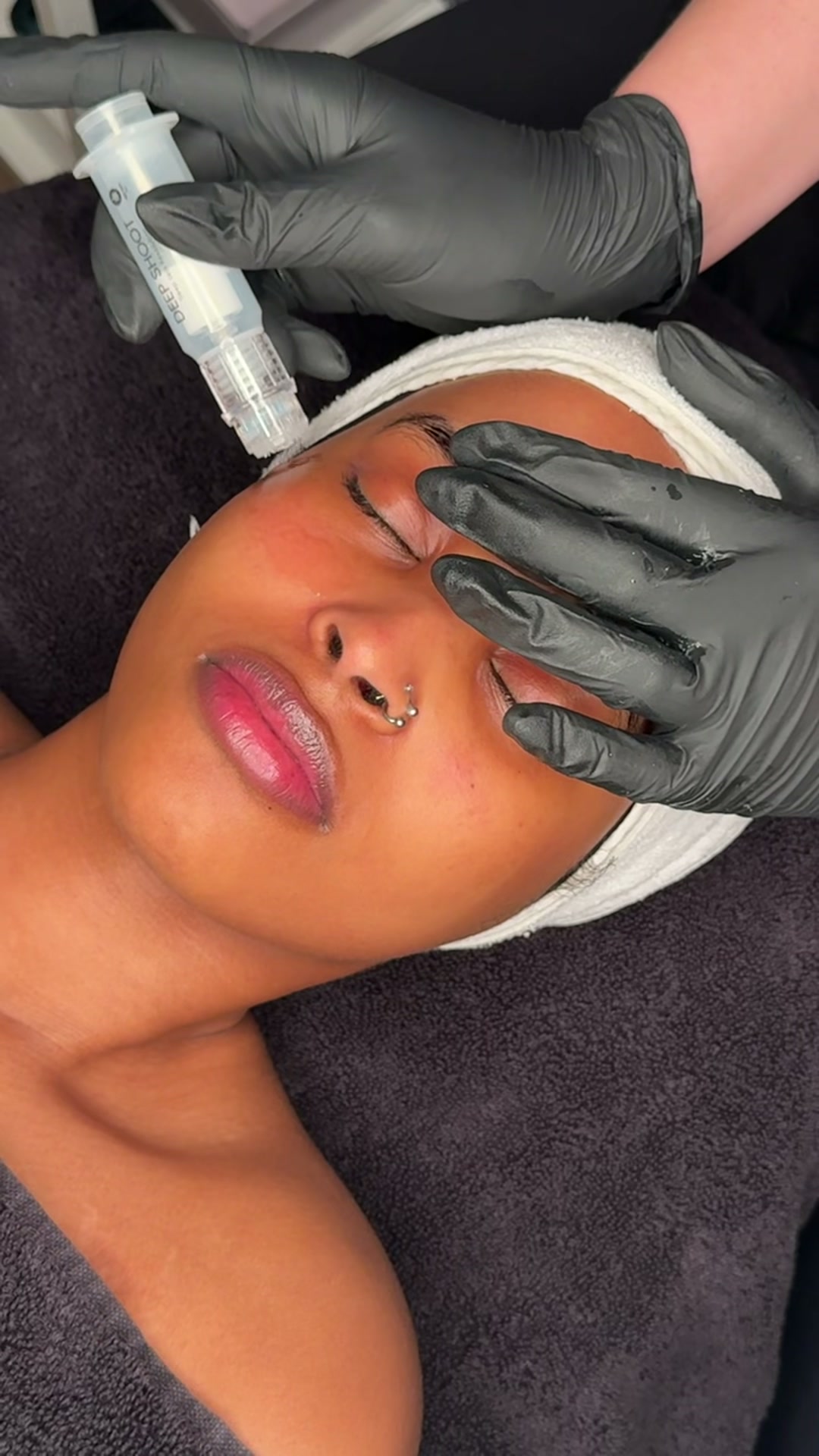 Ribeskin CO2 Terapi og Deep Shot hos EM Hudpleie Mosseporten